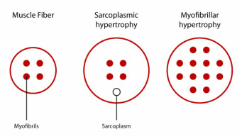 Hypertrofie